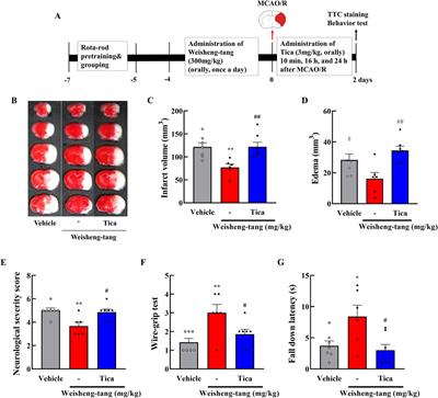 Weisheng-tang protects against ischemic brain injury by modulating microglia activation through the P2Y12 receptor